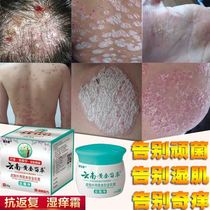 Psoriasis ointment Ren 1 Zhen Herbal anti-ringworm anti-itching seedling medicine Skin ringworm moss net folk remedy for foot moss foot stink ringworm itch