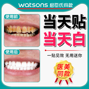 ホワイトニング歯ストリップは、黄ばんだ歯を除去し、歯を白くします。6D ダズリングホワイトパッチ、歯を白くするアーティファクト、黄ばんだ歯を除去し、歯を白くします。