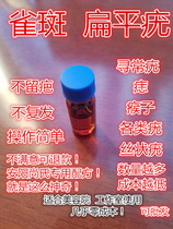 Shangs traditional Chinese medicine to remove flat warts and nevus freckle freckle liquid spotting water point nevus water beauty salon extract