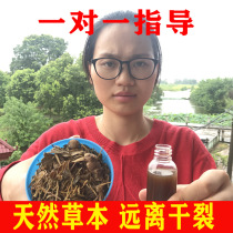 Hand and foot ear adult child antifreeze repair