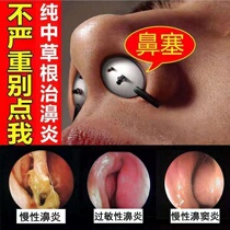 Nasal polyp medicine (dropped overnight) rhinitis spray nasal polyp nasal obstruction turbinate hypertrophy anti-inflammatory repair artifact