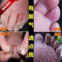 Bo Run skin antibacterial Beriberi cream Aobo Aobo Run Bo foot odor anti-itching peeling boxed official website 
