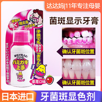 Dental plaque display agent Japanese children oral removal color removal tartar artifact indicator staining liquid toothpaste