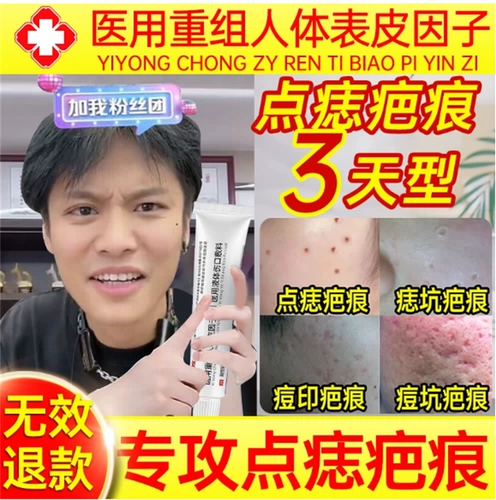 После заказа родинок удаление шрамов восстановляет грани рука