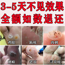 Corns paste Corns stick toe warts net brush removal Hand and foot meat thorn root Corns special medicine artifact correction