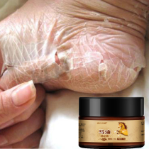 (Buy one get one free)Beriberi buster~stay away from chapped~Chapped hands and feet peeling a touch to restore moisturizing and moisturizing