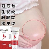 Pregnant women remove pregnancy pregnancy pregnancy pregnancy postpartum repair cream prevention special olive oil to eliminate tightening artifact obesity