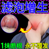 Special ointment for treating follicular hyperplasia and chronic pharyngitis with foreign body sensation in throat