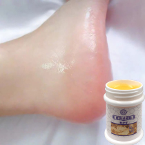  Beeswax Foot Crack Cream cracked heel cracked peeling cracked hands and feet cracked feet dead skin calluses hand cream