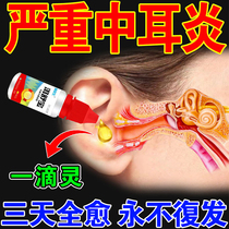 Special medicine for otitis media (Root removal) anti-inflammatory ear drops ointment for the treatment of inflammation and pus in the ear