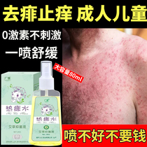 Prickly Antiprickly water adult Go to prickly spray liquid dispel heat and heat Heat Prickly Cream Child baby Divinity Pink in addition to florist