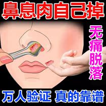 Nasal polyp medicine (painless shedding) acute and chronic rhinitis turbinate hypertrophy nasal congestion sinusitis nasal artifact spray
