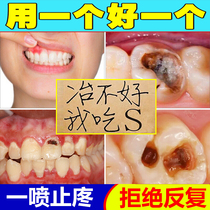 Tooth pain pain medicine Quick-acting special treatment of swollen gums pain inflammation fire artifact wisdom tooth decay tooth pain ning spray