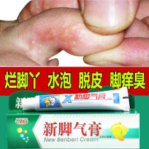 New beriberi cream Rotten feet anti-itch peeling care Foot foaming External toe crack foot odor cream