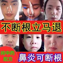 Allergic rhinitis cream Miao Family special treatment turbinate hypertrophic sinusitis nasal congestion Nasal septum deviation Japanese nemesis medicine