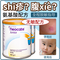 Neocate Neocate Vanilla flavor Amino acid Milk Powder junior1 Infant Hypoallergenic Fully hydrolyzed 400g