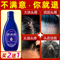 Anti-dandruff anti-itching oil control shampoo pharmaceutical antifungal special ointment for dandruff serious dandruff artifact