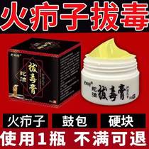 Treat fire Furuncle Uprooted drug paste Drug paste with goose pimple acne red swollen hair and hard lump hair follicle sucking abscess