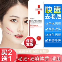 Siweijing Siwei scar removal cream Baba Beijinglikang scar removal repair Yashibang scar removal cream Baofu Weining Ping
