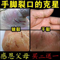 Elderly children can use hands and feet to prevent dry cracks cracked heels cracked fingers dry rough peeling horse cream
