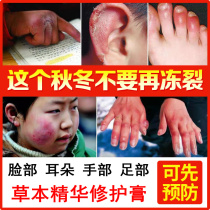 Frostbite cream Hands and feet Dry skin peeling Ears Skin care products Childrens repair cream Chapped mouth crack cream Heel