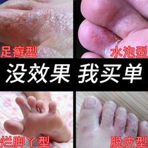 Rotten does not contain foot shop spray cream Foot odor(Royal Doctor Square water blister sweat foot peeling itchy powder) Foot soak foot enterprise