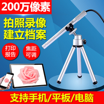  High-definition colposcopy gynecological visual inspection beauty salon cervical peep private instrument gynecological examination vaginal endoscope