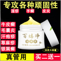  Cure hair follicle inflammation stubborn moss wet poison cream peeling hands and feet sweat blisters blisters rash chapped hands and feet quick anti-itching and antibacterial cream