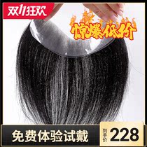 Male hairline wig patch forehead replacement film M-type bangs back high forehead hair loss really handsome invisible