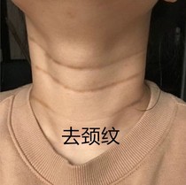 (Little Red Book recommends neck membrane) Say goodbye to the neck pattern and dont let the neck pattern expose your age ~ return your swan neck