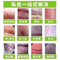 Mens balanitis dermatitis candida scrotum moist red dots white dots pearl rash cracked mouth itching set cream
