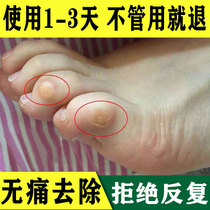 Painless Baiyun Pheasant eye patch potion corneal cream corrects Tong Ren Tang Renhe on the toes