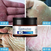 Seasonal hand peeling cream Adult cream Childrens foot peeling rough cracking Fingers burst skin Palm cracking Nourishing
