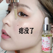 (Buy 2 hair 3) net rose essential oil to face black spots spots melanin does not leave marks