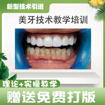 Yiwon Gia Resin Full Porcelain Veneered Ice Porcelain Tooth Medenture Ceramic Patch Teaching Materials Manufacturer Processed Direct Marketing