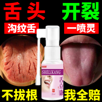Tongue crack crack crack tongue map tongue rotten tongue tongue tongue coating white thick burning mouth syndrome tongue sores cracking spray