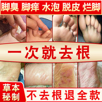 Eneriberi ointment root anti-itching peeling blisters fungus rotten feet sterilization spray foot smelly sweat artifact infection