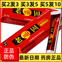 Buy 2 get 1] old stubborn skin ringworm cream Shenfang itching ointment antipruritic ointment itching skin antibacterial