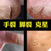 Horse oil cream Anti-cracking cream Hand peeling dry peeling Anti-cracking cream Foot cracking hand and foot cracking oil healing repair treatment