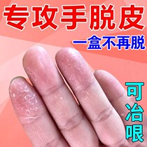 Hand peeling crack open hand peeling and severe treatment of childrens hand peeling of the drug hand peeling exfoliating keratinocytes laxative