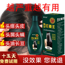 Anti-dandruff anti-itching shampoo Oil control in addition to mites to remove severe dandruff Childrens itchy head special artifact lotion