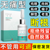 Remove plantar warts clean corns scorpions thorn monkey paste remove foot soles hands special artifact meat thorn warts spirit