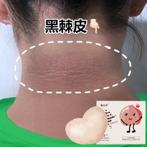 (Weiya recommended) The inner thighs are not black peach pp soap beautiful buttocks beautiful backs black butt soap buy 2 get 1