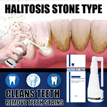 Dental calculus cleaning calculus dissolving spray bacteria deodorant Dental calculus lasting fresh