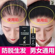 Japanese original imported music wash Heineken silk hair hair hair Chinese herbal official website