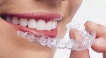 Opalescence American Opalescence whitening braces Small red book Huang Shengyi with the same