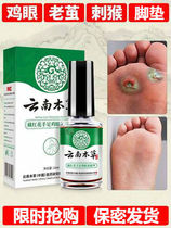 Yunnan materia medica chicken cocoon cream to remove calluses Dead skin thorn monkey meat thorn Mild plantar nerve net foot pad