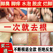Cure beriberi itchy feet rotten feet foaming and peeling artifact foot blister type foot odor stinky feet foot sweat cream