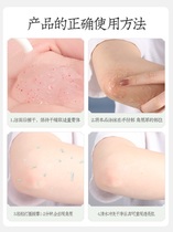 Say goodbye to natural black men and womens elbows to black exfoliate the body Full body exfoliation Neck whitening joint artifact